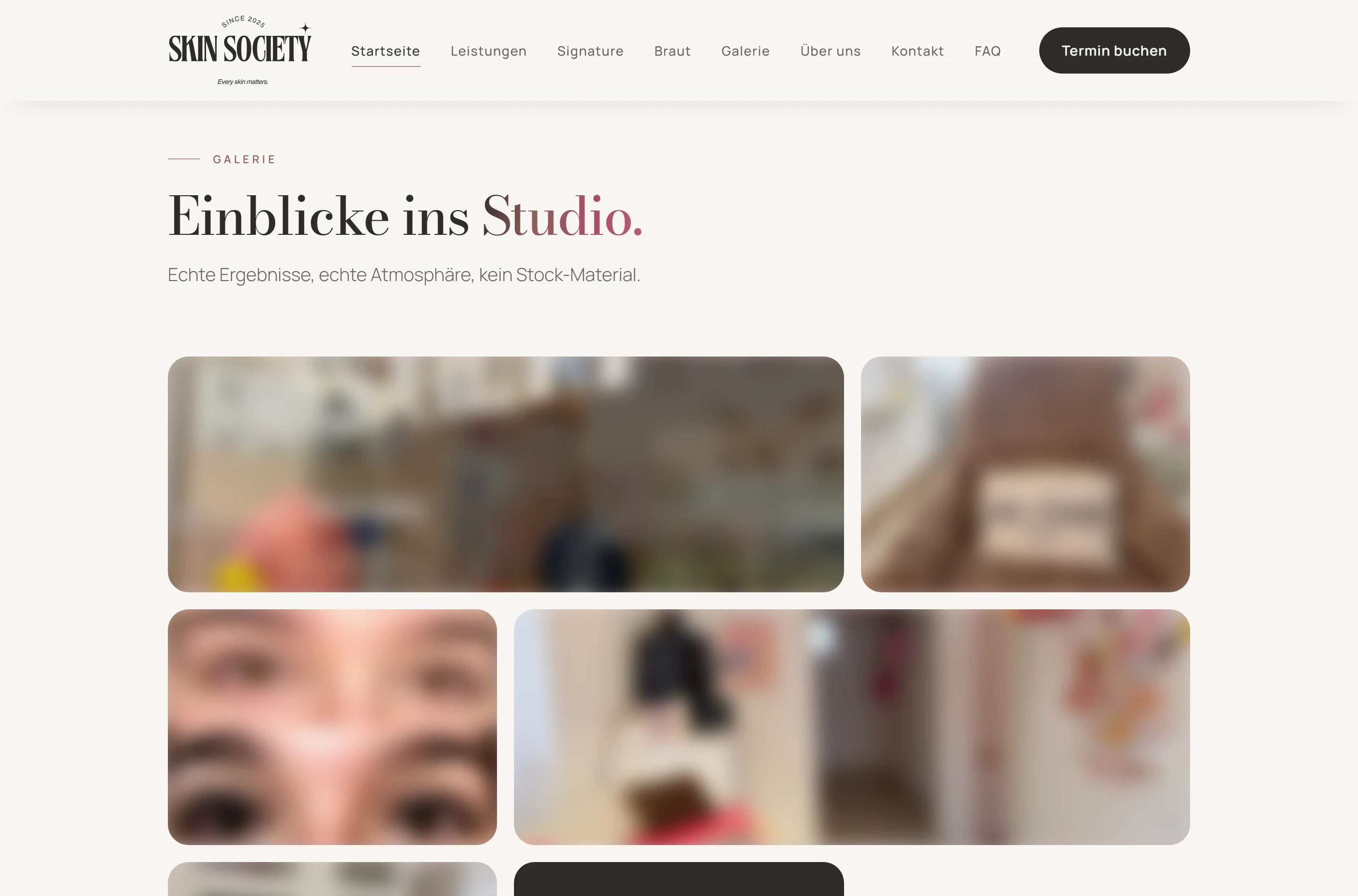 Galerie-Seite des neuen Skin-Society-Redesigns (Kundenfotos zum Schutz der Privatsphäre unscharf dargestellt, Rest der Seite unverändert scharf)