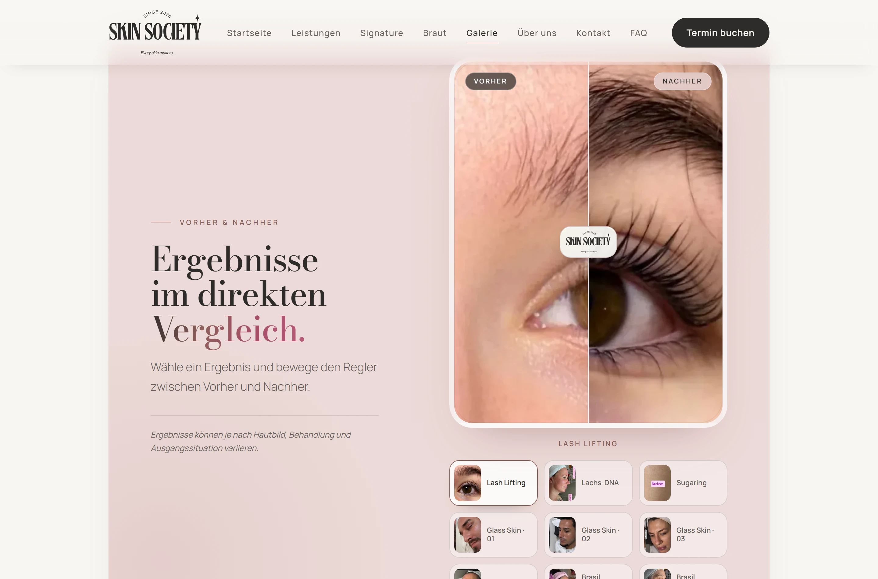 Echte Vorher/Nachher-Regler-Funktion auf der Skin-Society-Galerieseite: Filter „Vorher/Nachher“, Behandlung „Lash Lifting“ zum direkten Ziehen und Vergleichen
